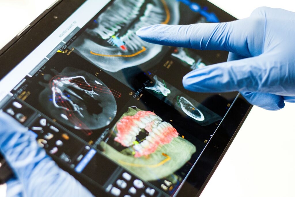 Dental provider reviewing digital X-rays and imaging on a tablet during a patient consultation